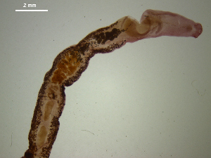  (Echinostoma trivolvis - Ec.GI.Oz.202.1)  @13 [ ] Copyright (2010) Sean Locke Environment Canada