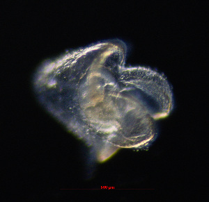 (Cerebratulus herculeus - ZHAK-03114)  @11 [ ] CreativeCommons Attribution Non-Commercial No Derivatives (2023) Hakai Institute Hakai Institute