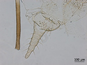  ( - Macrosiphum euphorbiae-P5)  @11 [ ] CreativeCommons - Attribution Share-Alike (2024) Unspecified University of Montreal