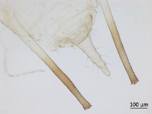  ( - Macrosiphum euphorbiae-P28)  @11 [ ] CreativeCommons - Attribution Share-Alike (2024) Unspecified University of Montreal