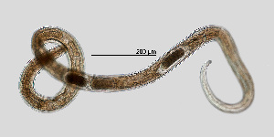  (Tripylidae - NEMA-40988-B10)  @11 [ ] by-nc (2023) Oleksandr Holovachov Swedish Museum of Natural History