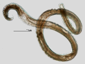  (Mononchidae - NEMA-40988-E11)  @11 [ ] by-nc (2023) Oleksandr Holovachov Swedish Museum of Natural History