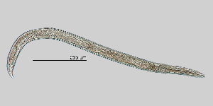  (Cephalobinae - NEMA-40988-F4)  @11 [ ] by-nc (2023) Oleksandr Holovachov Swedish Museum of Natural History