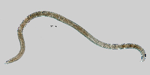  (Eudorylaimus pseudocarteri - NEMA-40988-H11)  @11 [ ] by-nc (2023) Oleksandr Holovachov Swedish Museum of Natural History