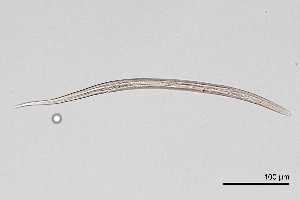  (Tylenchidae - NEMA-40989-D5)  @11 [ ] by-nc (2024) Oleksandr Holovachov Swedish Museum of Natural History