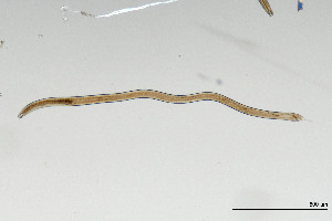  (Adoncholaimus thalassophygas - NEMA-40989-F6)  @11 [ ] by-nc (2024) Oleksandr Holovachov Swedish Museum of Natural History