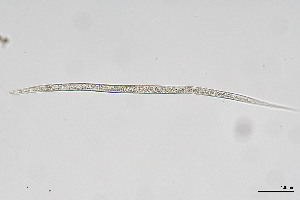  ( - NEMA-40989-H2)  @11 [ ] by-nc (2024) Oleksandr Holovachov Swedish Museum of Natural History