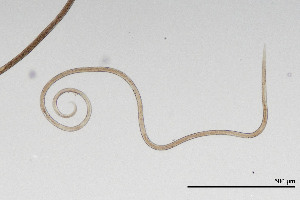  (Alaimus simplex - NEMA-40989-H11)  @11 [ ] by-nc (2024) Oleksandr Holovachov Swedish Museum of Natural History
