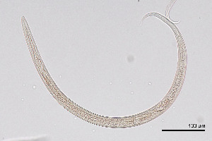  (Tylenchus - NEMA-40991-E5)  @11 [ ] by-nc (2024) Oleksandr Holovachov Swedish Museum of Natural History