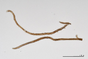  (Mylonchulinae - NEMA-40991-G7)  @11 [ ] by-nc (2024) Oleksandr Holovachov Swedish Museum of Natural History