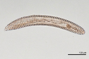  (Criconematinae - NEMA-40991-G10)  @11 [ ] by-nc (2024) Oleksandr Holovachov Swedish Museum of Natural History