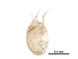  (Histiostomatidae - BIOUG22105-F06)  @13 [ ] CreativeCommons - Attribution (2015) CBG Photography Group Centre for Biodiversity Genomics