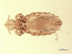  (Hoplopleuridae - 07PROBE-06337)  @14 [ ] CC-0 (2007) Crystal Sobel & Maria Arroyo, Biodiversity Institute of Ontario Unspecified