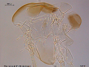  ( - XL344)  @11 [ ] CreativeCommons - Attribution Non-Commercial Share-Alike (2015) NTNU University Museum, Department of Natural History NTNU University Museum, Department of Natural History