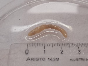  ( - ABOL-25-0372)  @11 [ ] Unspecified (default): All Rights Reserved (2025) Edith Gruber Unspecified