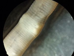  ( - ABOL-25-0333)  @11 [ ] Unspecified (default): All Rights Reserved (2025) Edith Gruber Unspecified