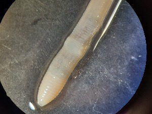  ( - ABOL-25-0333)  @11 [ ] Unspecified (default): All Rights Reserved (2025) Edith Gruber Unspecified