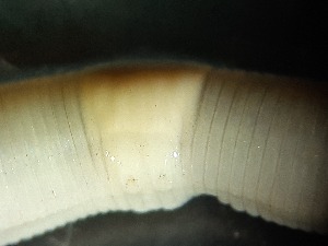  ( - ABOL-25-0321)  @11 [ ] Unspecified (default): All Rights Reserved (2025) Edith Gruber Unspecified