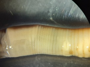  ( - ABOL-25-0343)  @11 [ ] Unspecified (default): All Rights Reserved (2025) Edith Gruber Unspecified