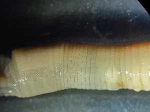  ( - ABOL-25-0343)  @11 [ ] Unspecified (default): All Rights Reserved (2025) Edith Gruber Unspecified