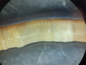  ( - ABOL-25-0358)  @11 [ ] Unspecified (default): All Rights Reserved (2025) Edith Gruber Unspecified