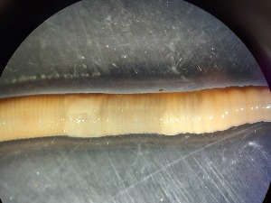  ( - ABOL-25-0358)  @11 [ ] Unspecified (default): All Rights Reserved (2025) Edith Gruber Unspecified