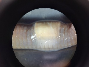  ( - ABOL-25-0357)  @11 [ ] Unspecified (default): All Rights Reserved (2025) Edith Gruber Unspecified