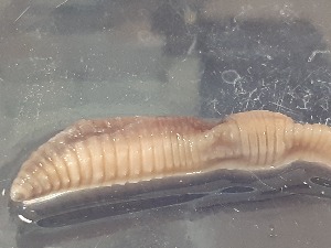  ( - ABOL-25-0312)  @11 [ ] Unspecified (default): All Rights Reserved (2025) Edith Gruber Unspecified