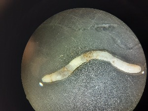  (Imetescolex - ABOL-25-0309)  @11 [ ] Unspecified (default): All Rights Reserved (2025) Edith Gruber Unspecified