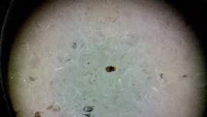  ( - ABOL-24-1343)  @11 [ ] Unspecified (default): All Rights Reserved (2025) Johannes Schall Unspecified