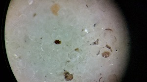  ( - ABOL-24-1343)  @11 [ ] Unspecified (default): All Rights Reserved (2025) Johannes Schall Unspecified