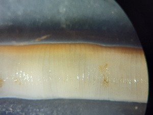  ( - ABOL-25-0374)  @11 [ ] Unspecified (default): All Rights Reserved (2025) Edith Gruber Unspecified