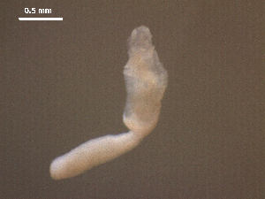  (Diplostomum huronense - D.IN.SNI.La.1.20)  @13 [ ] Copyright (2010) Sean Locke Environment Canada