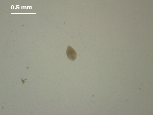  (Diplostomum sp. 8 - D.RL.Bo.Rp.101.1)  @11 [ ] Copyright (2010) Sean Locke Environment Canada