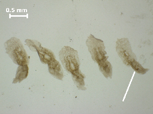  (Posthodiplostomum sp. 4 - P.GRI.Ah.1F.1)  @12 [ ] Copyright (2010) Sean Locke Environment Canada