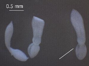  (Posthodiplostomum sp. 3 - P.LM.O.S.5.3)  @11 [ ] Copyright (2010) Sean Locke Environment Canada