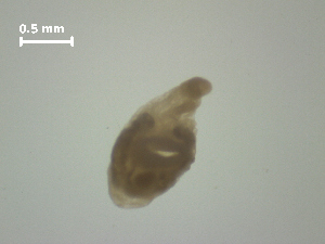  (Sphaeridiotrema pseudoglobulus - Sp.IN.Mtl.Aya.1.1)  @13 [ ] Copyright (2010) Sean Locke Environment Canada