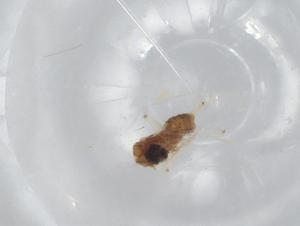  ( - BIOUG99140-H03)  @11 [ ] CreativeCommons - Attribution (2023) Centre for Biodiversity Genomics Centre for Biodiversity Genomics