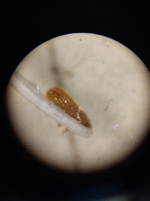  ( - 18-UTSC-PJ-COL-031.1)  @11 [ ] CreativeCommons  Attribution (Praveen Jayarajan) (2019) Praveen Jayarajan UTSC MacIvor lab