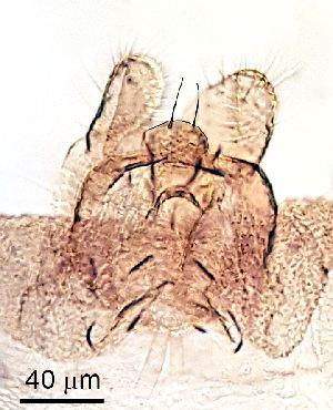  ( - 2024.08.22 Cecidomyiidi BOLD:AAN5271(C56))  @11 [ ] CreativeCommons - Attribution Share-Alike (2025) Unspecified University of Lausanne