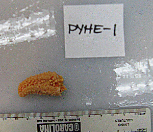  ( - PYHE-1)  @11 [ ] No Rights Reserved  Unspecified Unspecified