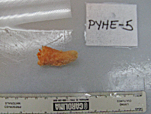  ( - PYHE-5)  @11 [ ] No Rights Reserved  Unspecified Unspecified