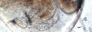  ( - ZPJW32)  @11 [ ] Copyright (2015) PHCDBS PAUL HEBERT CENTRE FOR DNA BARCODING AND BIODIVERSITY STUDIES