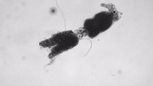  (Ergasilus luciopercarum - ZOOPS_0627)  @11 [ ] BY-NC-ND (2019) Joe Connolly Cornell University